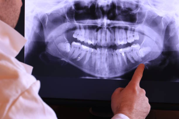Best Emergency Dental Surgery in South Glens Falls, NY